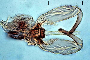 Macrodiplosis #b